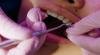 Best Treatments To Facilitate Preventive Dental Care